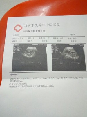 刚怀孕要检查什么