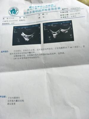 怀孕40天小孩有多大