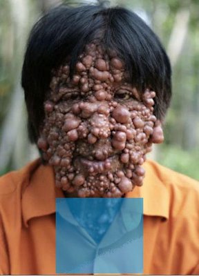 梦见自己怀孕想打掉