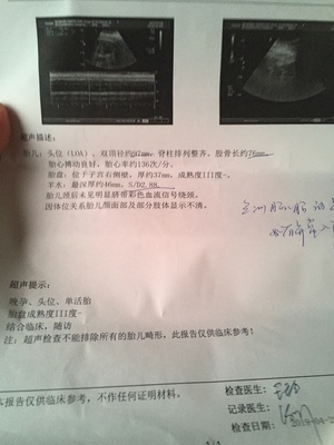 38周吸氧对胎儿好吗