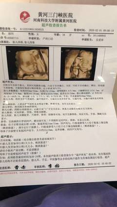 抽烟怀孕了能要吗
