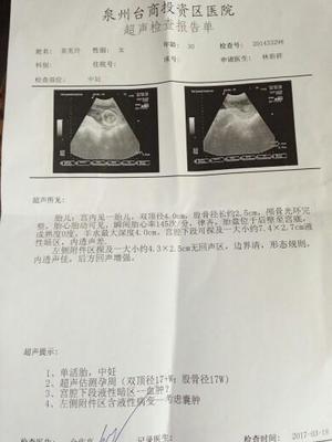怀孕半个月肚子疼
