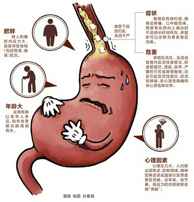 偶尔食道疼是怎么回事