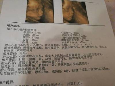 怀孕24周胎儿发育标准