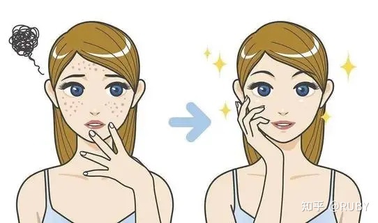 长痘痘应该怎么处理