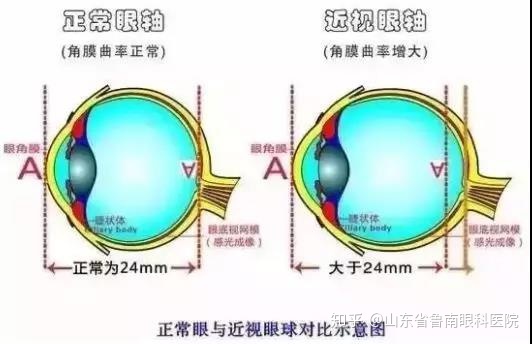 弱视是怎么回事