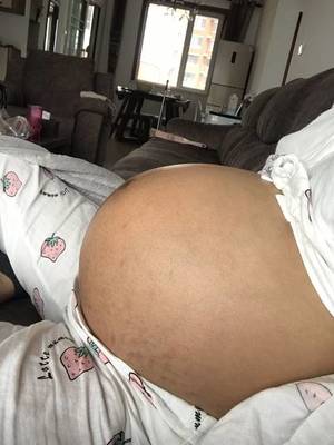 做梦腰疼
