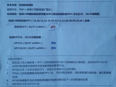 宫颈息肉会影响胎儿吗