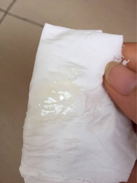 排卵期白带乳白色