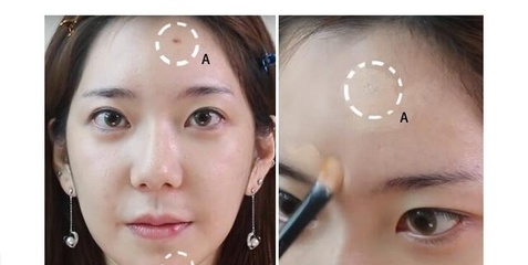 痘痘可以用遮瑕