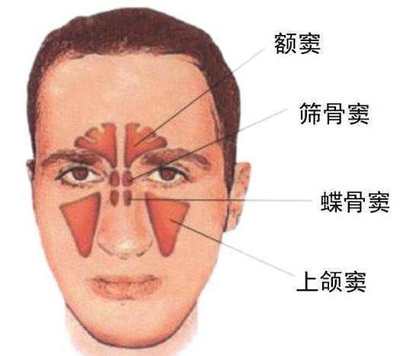 上颚有血丝是怎么回事