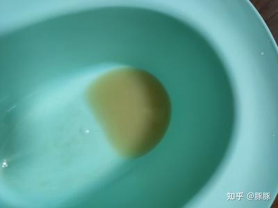 小便混沌是怎么回事