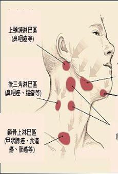 脖子两侧淋巴疼是怎么回事