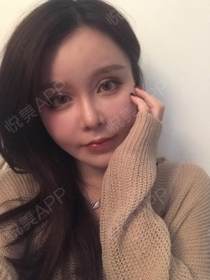 贴双眼皮睡觉