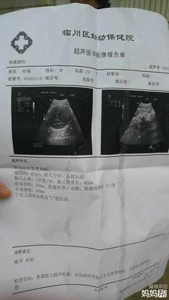 胎儿入盆多久能生