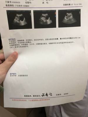 怀孕半个月会流产吗