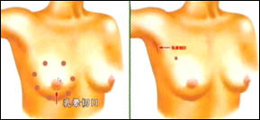 乳头疼是不是怀孕前兆