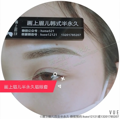 芜湖割双眼皮壹加壹优