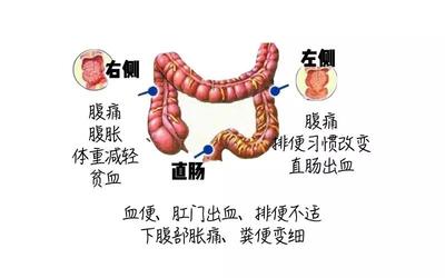 肚子左边胀疼是怎么回事