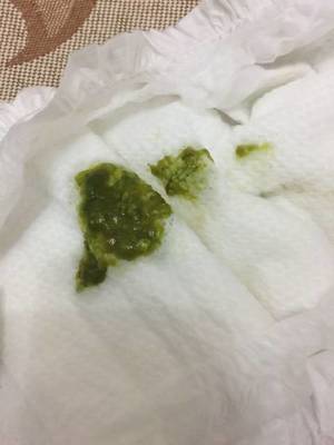 拉的粑粑是绿色的怎么回事