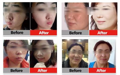 25岁学美容晚不晚