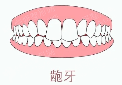牙齿紧绷是怎么回事
