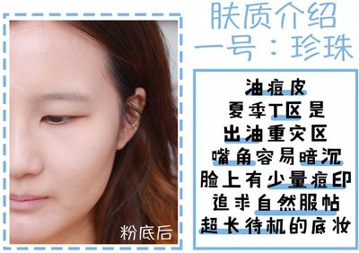 脸油长痘痘用什么散粉
