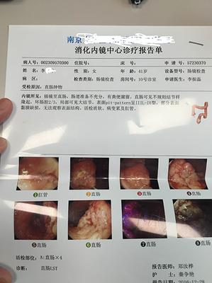 直肠腺瘤怎么治疗方法