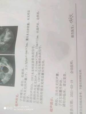 怀孕后白带多是怎么回事