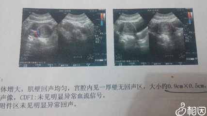 怀孕四十五天有什么反应