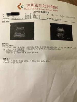 怀孕3个月胎儿多大