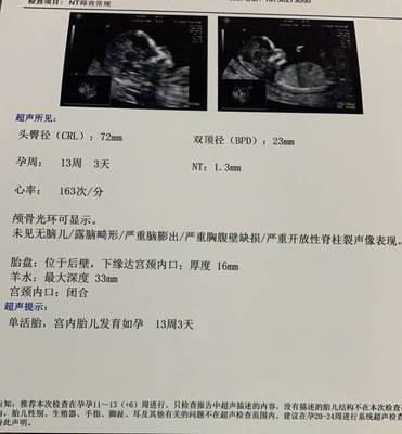 怀孕13周还用吃叶酸吗