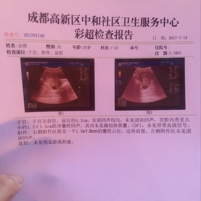 怀孕7周有胎心胎芽吗