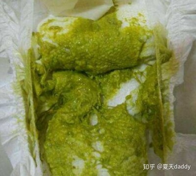 新生儿绿色大便