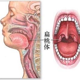 嗓子一侧疼是怎么回事