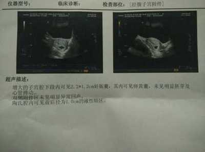 怀孕胚芽是什么意思