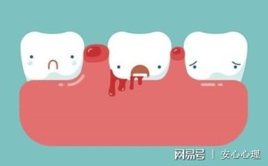 蛀牙引起的牙疼怎么办