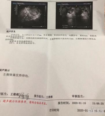 卵巢里有多少个卵泡正常吗