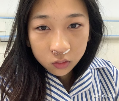 鼻子发酸是怎么回事