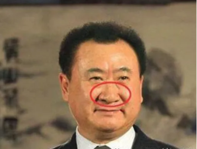 鼻翼一大一小面相