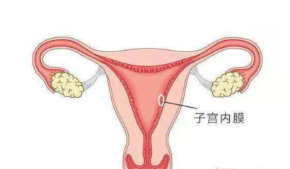 刮宫是怎么回事
