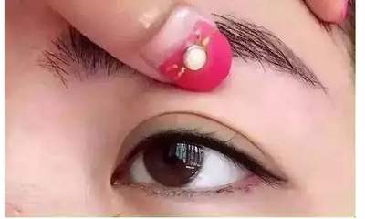 割双眼皮了能吃鸡蛋吗