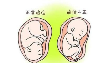 怀孕多久定胎位