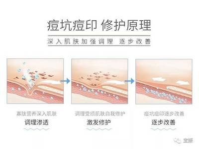收缩毛孔的原理