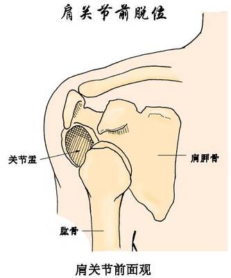 肩关节疼痛怎么治疗