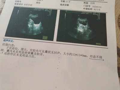 怀孕四十五天有什么反应