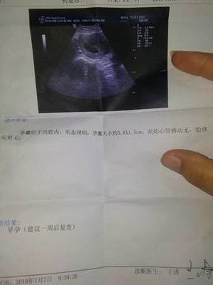 女生两个月来一次月经正常吗