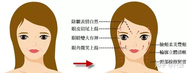 脸部麻是怎么回事