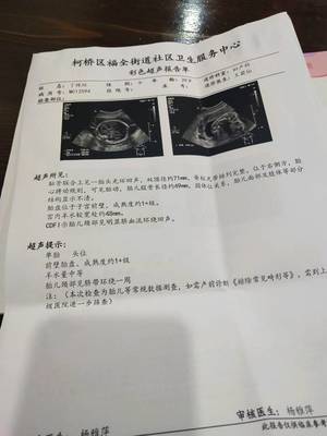 怀孕26周胎儿有多大