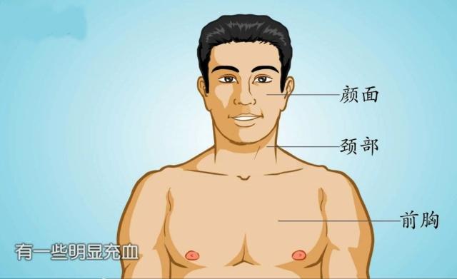 脖子充血是怎么回事